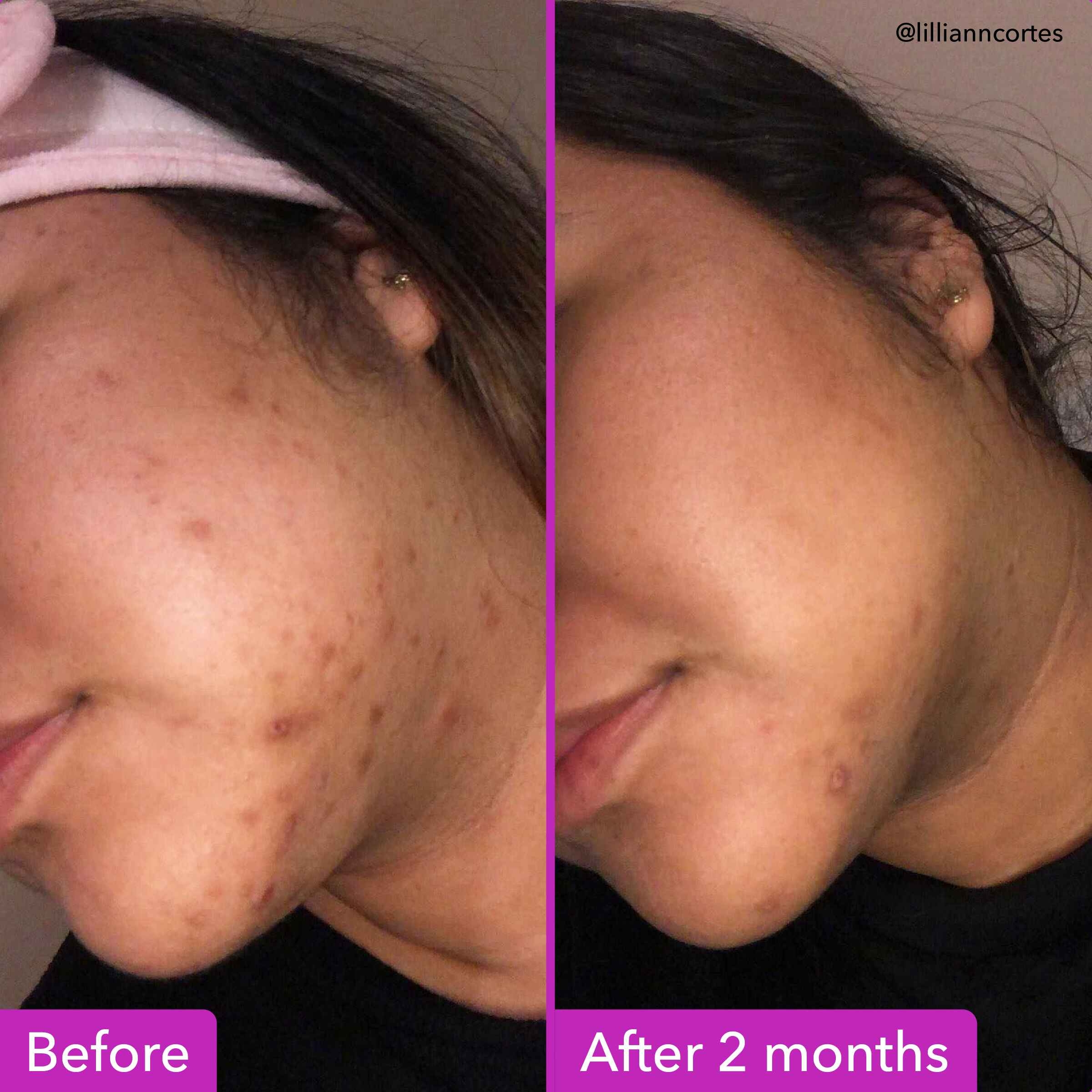 Sérum correcteur de décoloration Good Molecules