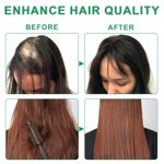 product_image_name-Generic-Huile de Batana Kizenka (120g) – Soin Capillaire Naturel à la Biotine, Stimule la Croissance, Nourrit le Cuir Chevelu et Prévient la Chute des Cheveux-3