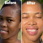 product_image_name-Generic- Kit Longrich -5