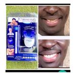 product_image_name-White Label-Blanchissement dentaire rapide 20 Minute Dental White-2