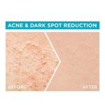 product_image_name-Garnier-Sérum Sakura Glow 30X Hyaluron Booster Serum - 30 ml-4