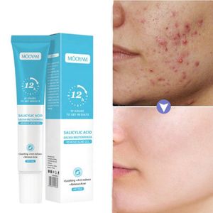 Mooyam Gel Anti-Acné à l’Acide Salicylique – Traitement Rapide Boutons et Imperfections (12h)
