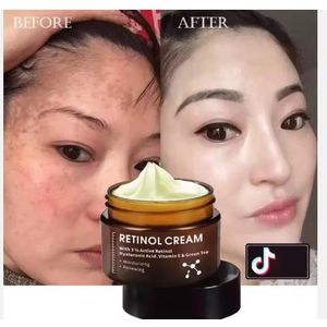 Retinol creme anti ride Retinol