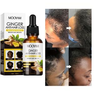 Sérum Capillaire Revitalisant Anti-Chute au Gingembre 30ml