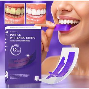 Nouvelle bande blanchissante pour les dents FluxArco V34 sans alcool, sans résidus avec 14 paires pour usage domestique 