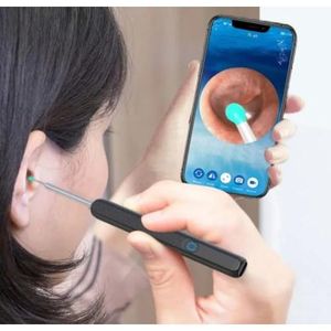 Kit Nettoyeur d’Oreilles Électrique avec Caméra HD – Otoscope Sans Fil Rechargeable – Nettoyage Oreille Précis avec Application Smartphone