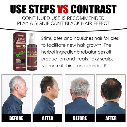 product_image_name-Unbrand-Pompe a Base de Plantes pour Noircir  Cheveux Blancs Tout Type Unisexe-2