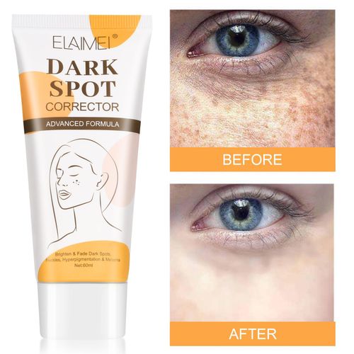 product_image_name-Generic-Creme ELAIMEI/Org Dark Spot Corrector : Votre solution avancée pour un teint uniforme et lumineux-2