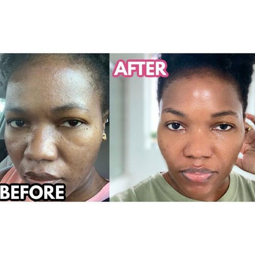 product_image_name-Menarini-Gel A-Ret Tretinoin 0,05% p/p -2