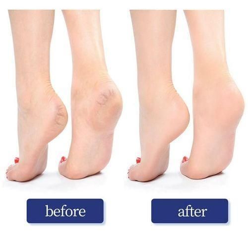 product_image_name-Generic-Pierre ponce - Nettoyage des pieds - Pierre d'élimination de la peau - Nettoie et exfolie - Pierre de soin des pieds - Pierre ponce pour callosités-4