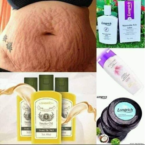 product_image_name-Generic- Kit Longrich -2