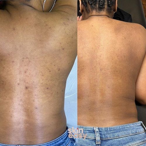 product_image_name-Generic- Kit Longrich -3