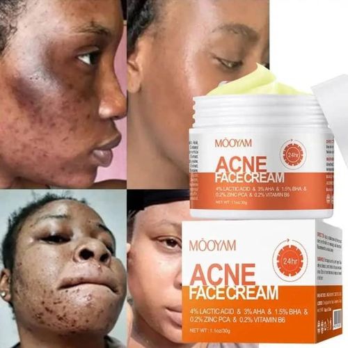 product_image_name-Generic-Crème visage anti-acné - Anti bouton et Tâches  24h Mooyam - 100g-1