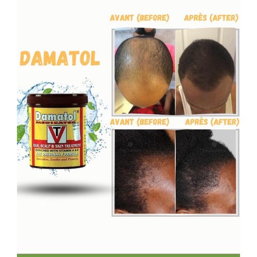 product_image_name-Generic-Pommade Damatol -1