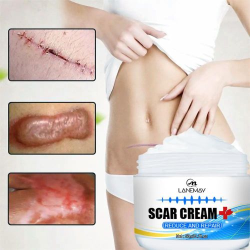 product_image_name-Generic-Crème Réparatrice LANEMAY – Formule Avancée pour Marques d'Acné et autres– 50ml-1