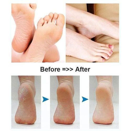 product_image_name-Generic-White Label Éliminateur de callosités électriques sans fil, Lime À Pieds Électronique Pédicure, Peau Parfaitement-1