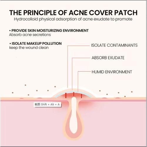 product_image_name-Generic-Gentle Repair Facial Cleansing Acne Invisible Coverage Patch-5