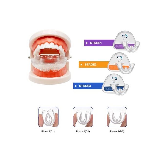 Haute qualité Dents dent orthodontique formateur d'appareils alignement  pour Adulte Bretelles oral hygiène équipement de dent - Cdiscount  Electroménager